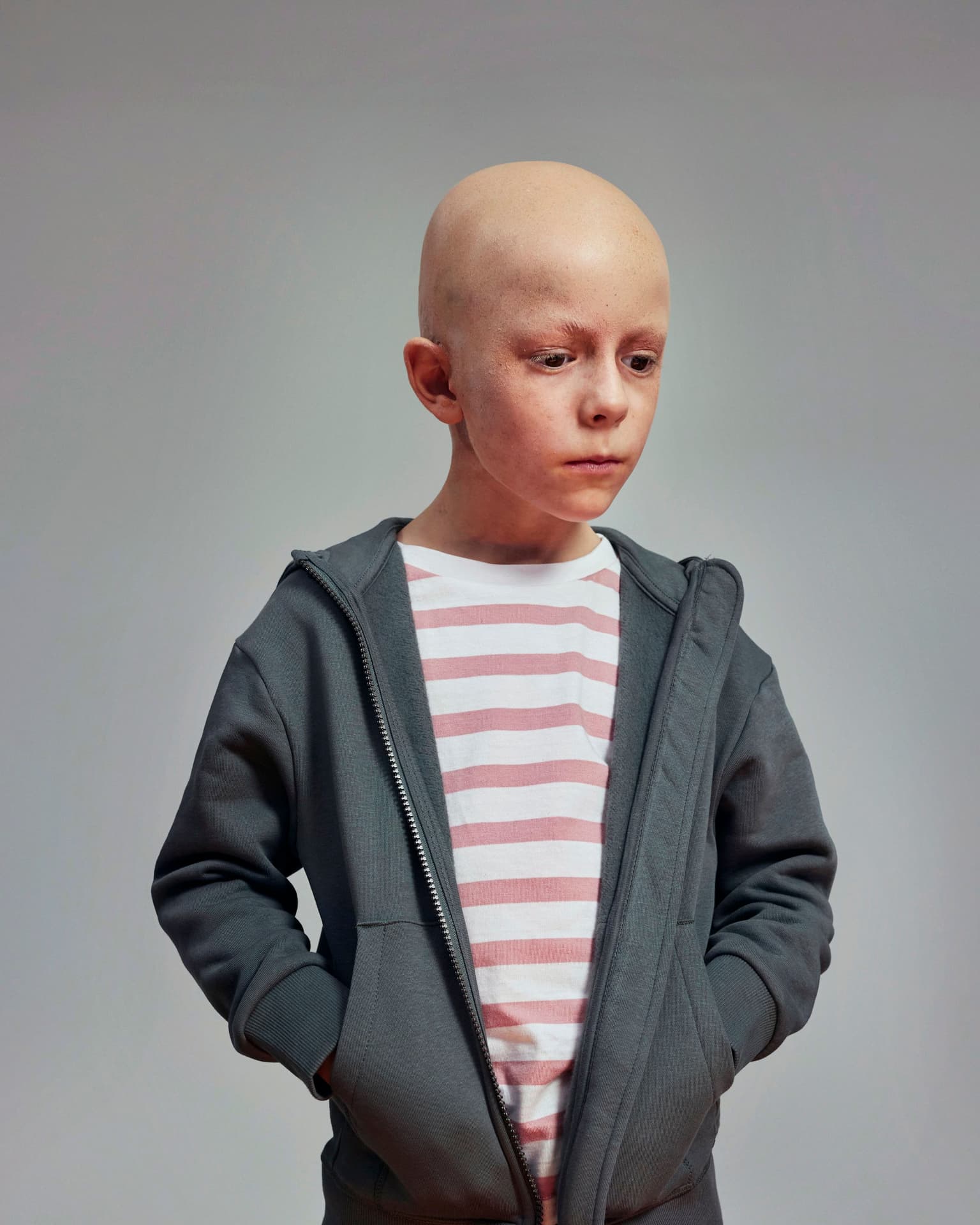 young boy with bald cap